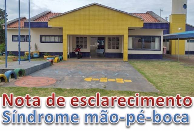 NOTA DE ESCLARECIMENTO: SÍNDROME MÃO-PÉ-BOCA