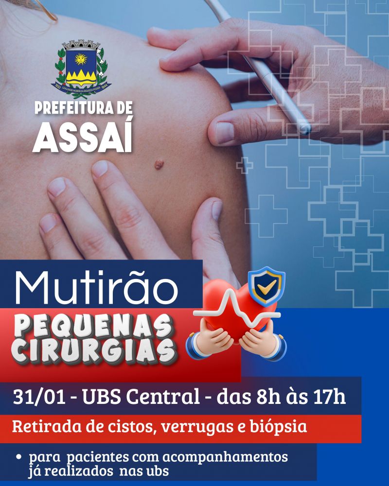 PREFEITURA REALIZARÁ MUTIRÃO DE PEQUENAS CIRURGIAS NO DIA 31/01
