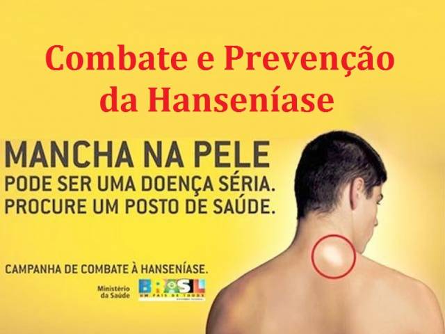 Prevenção da Hanseníase